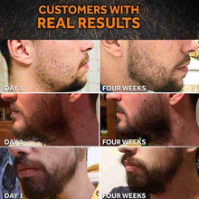 Professional Essential Nourishing Beard Set